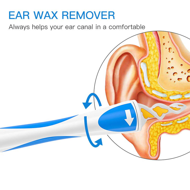 [Australia] - Ear Wax Remover, Ear Cleaner Tool Kit for Human Smart Spiral Earwax Removal Tool with 16 pcs Washable Tips, Safe and Soft, Suitable for Kids & Adults 