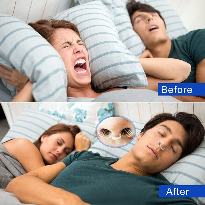 [Australia] - Snore Stopper Mouth Guard Anti Snoring Solution With 4 Nose Vent For Easing Breathing And Comfortable Sleep Suitable For Men And Women 