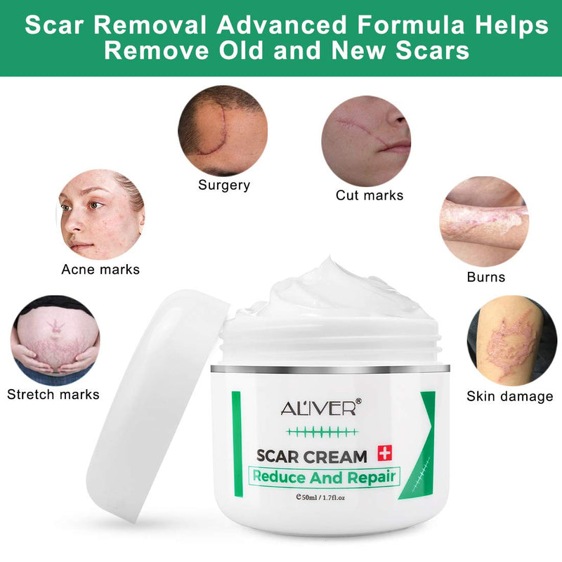 [Australia] - Aliver Scar Removal Cream for Old & New Scars, Stretch Mark Remover for Men & Women, Acne Scar Removal on Face or Body, Scar Treatment for Cuts,Surgery, Burn, Cut, Keloid, C-Section 