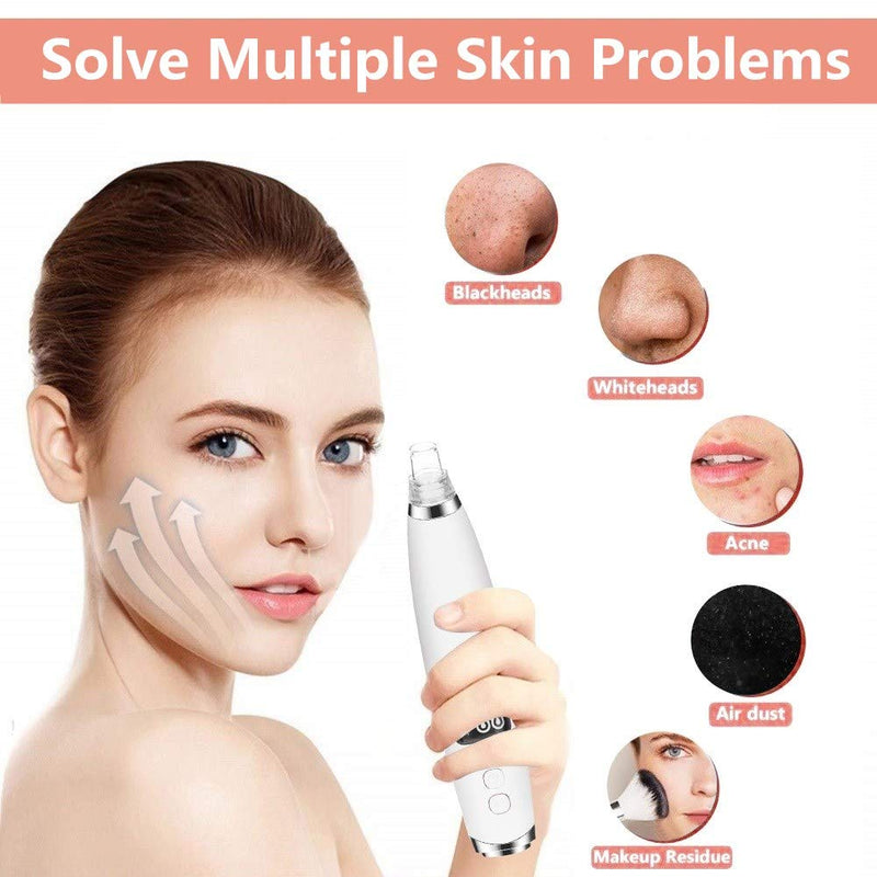[Australia] - GORGEOU Blackhead Remover Vacuum, Electric Facial Nose Acne Pore Cleaner with Hot Compress USB Rechargeable and 6 Probes Pimple Sucker Machine White 