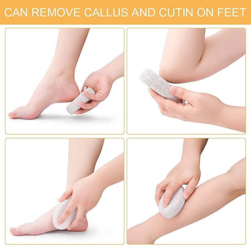 [Australia] - Voarge 2 Pieces Natural Pumice Stone, Foot Stone Lava Stone Pedicure Foot Care Foot Scrub for Removing Dead Skin, Callus Hard Skin Removal for feet and Hands 