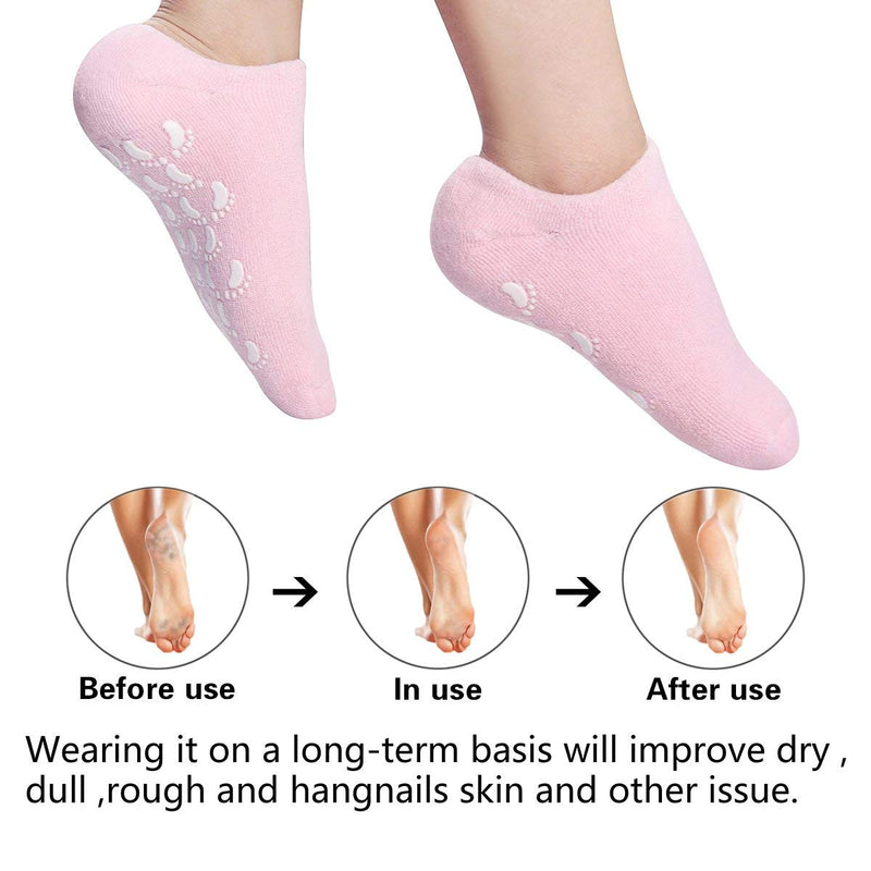 [Australia] - Moisturizing Socks Heel Gel Sock - Callus Rough Foot Care Treatment Soft Silicone Gel Lined Infused Lotion Spa Socks|2 Pairs Cotton Gel Sleeves For Repairing Softening Dry Cracked Feet Skins Blue & Pink 