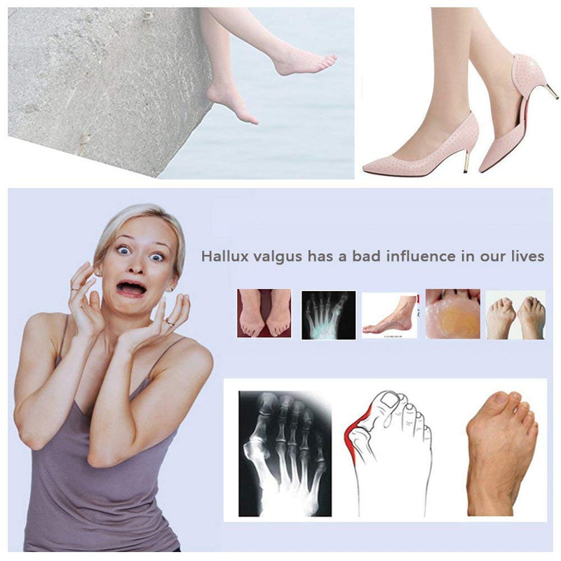 [Australia] - Bunion Corrector, Bunion Splints and Bunion Relief for Hallux Valgus, Big Toe Joint,Adjustable Bunion Splint Protector Sleeves kit F or Women and Men,7 pcs blue 