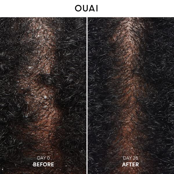 [Australia] - OUAI Anti-Dandruff Shampoo with Salicylic Acid. Gentle Hair Cleanser for Flaky and Dry Scalp. Reduce Itching, Redness, and Irritation (10 Fl Oz / 300ml) 