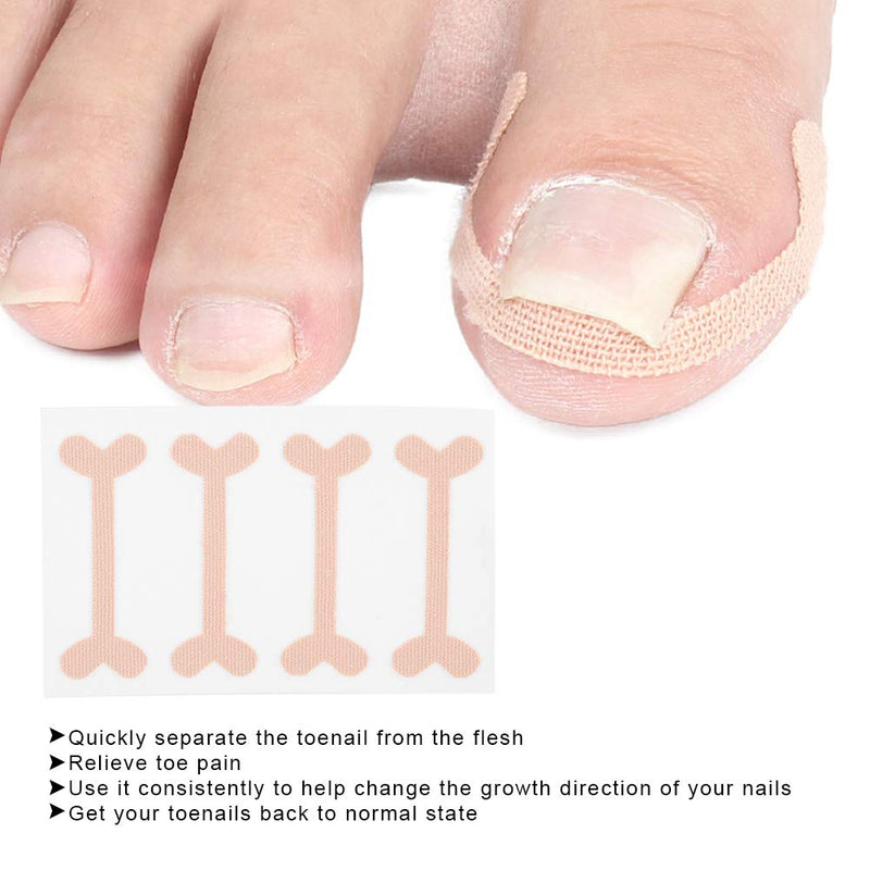 [Australia] - Ingrown Toenail Correction Sticker, 24pcs Paronychia Treatment Band Sticker Toenail Correction Bandage Foot CareTool for Pain Relief 