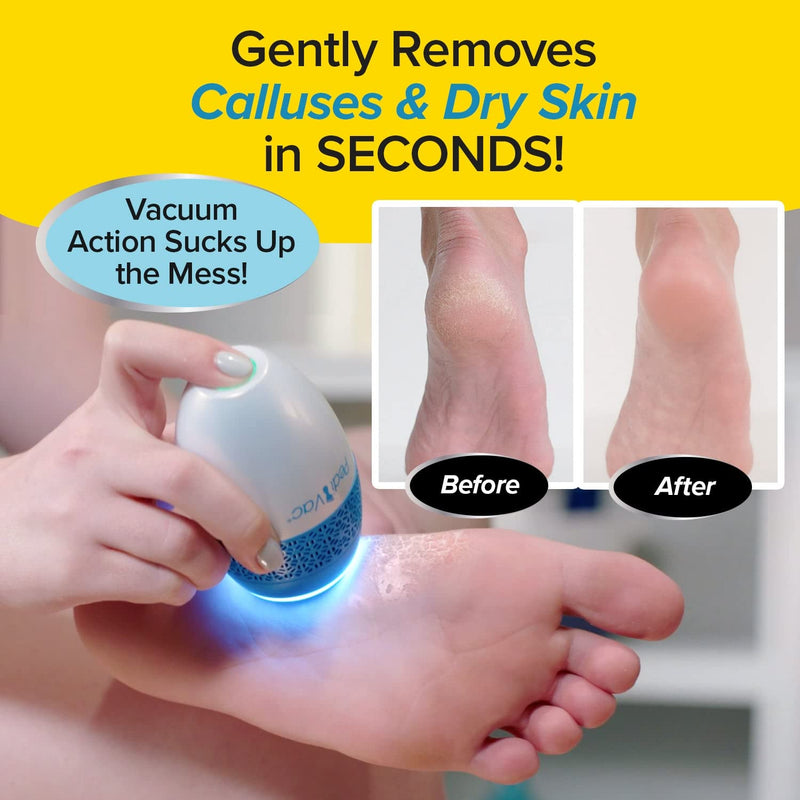 [Australia] - As Seen On TV PediVac Electric Callus Remover + Built-In Vacuum Sucks Up Shavings, New Look, Gently Removes Calluses & Dry Skin in Seconds, Mess-Free, Spins at 2000 RPMs, LED Light, 2 Speed Settings 