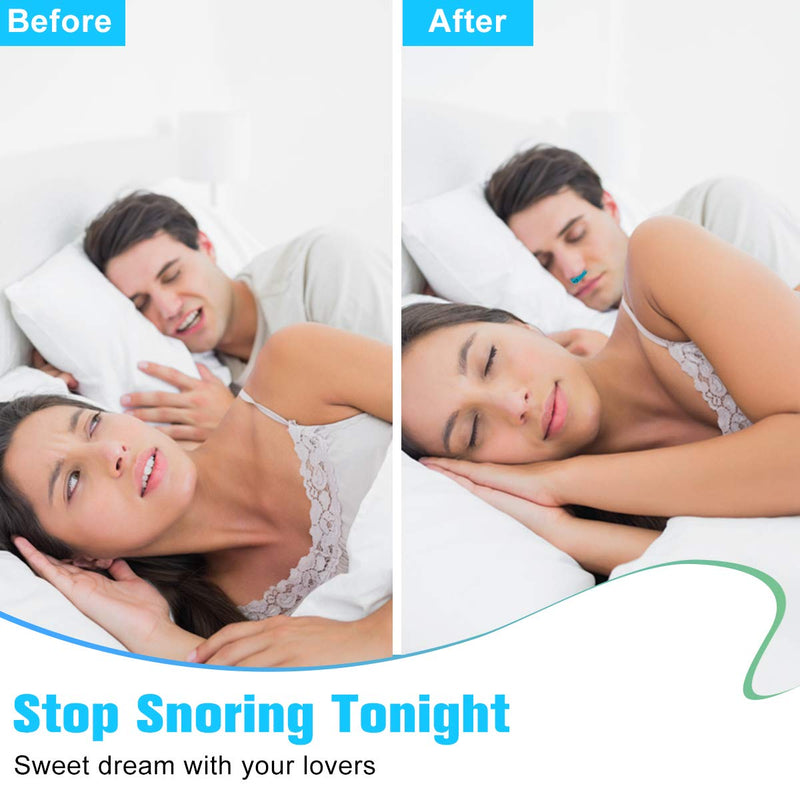 [Australia] - Upgrade 2-in-1 Anti Snoring Devices, Snoring Solution Nasal Dilator Nose Vents Plugs Clip Stop Snoring Aids Snore Stopper Reduce Snoring Sleeping Aid Device for Comfortable Sleeping Safe Snore Relief 1pcs 