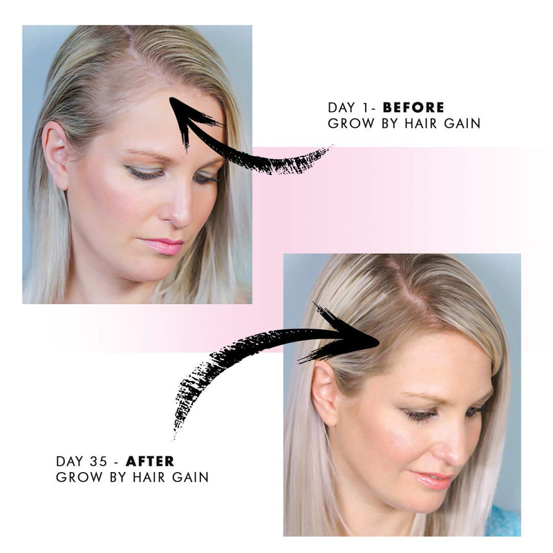 [Australia] - Grow by Hair Gain 1 Month supply 60 Capsules Fuller Thicker Hair in one month 