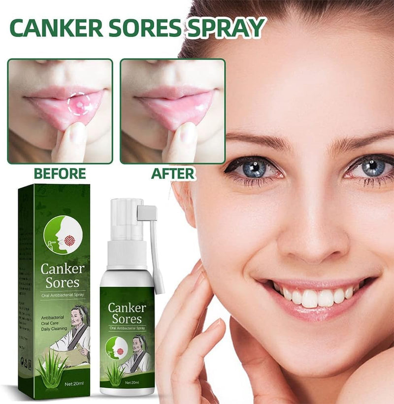 [Australia] - Ulcer Breath Sprays,Oral Ulcer Sprays,Antiviral Mouth Spray,Canker Relief Spray,Breath Spray for Bad Breath,Herbal Mouth Spray,Mouth Ulcer Sprays 20ML 