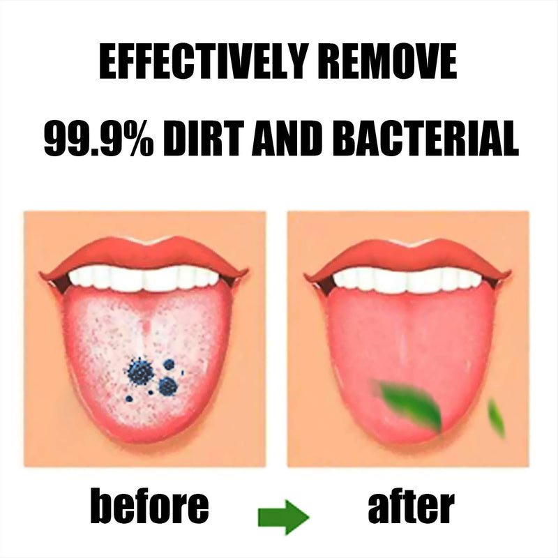 [Australia] - Tongue Brush, Tongue Scraper, Tongue Cleaner, Tongue Scraper Brush, Tongue Scraper Cleaner, Tongue Brushes, Helps Fight Bad Breath, 5 Tongue Scrapers, 5 Pack 