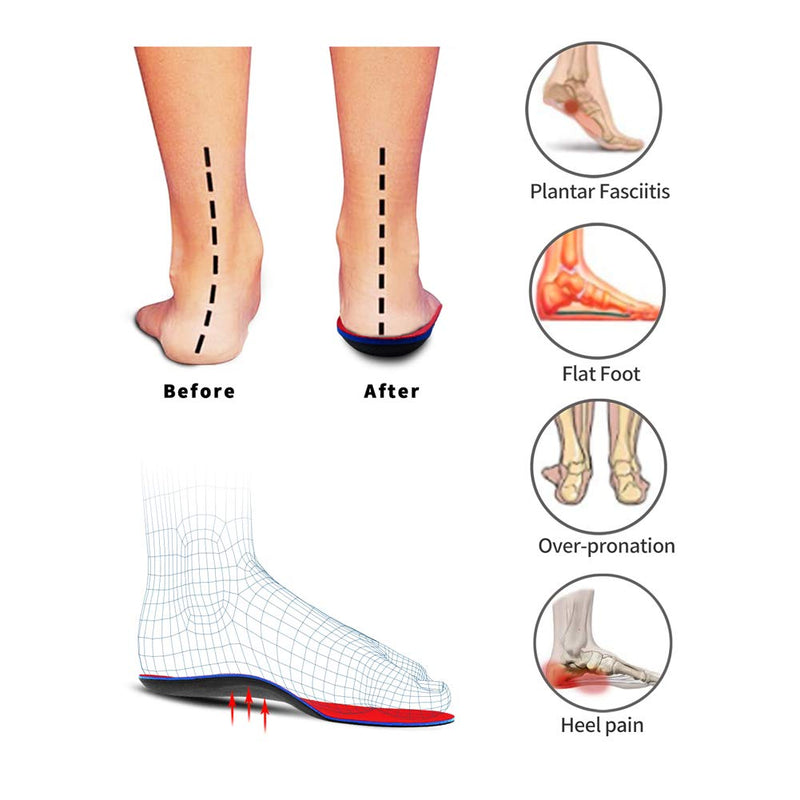 [Australia] - PCSsole Orthotic Arch Support Shoe Inserts Insoles for Flat Feet,Feet Pain,Plantar Fasciitis,Insoles for Men and Women Mens 6-6 1/2 | Womens 8-8 1/2 (9.84 Inch) 