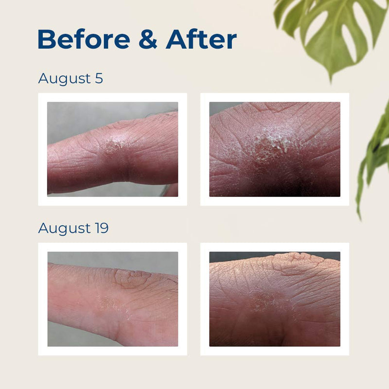 [Australia] - Gloves in a Bottle Skin Repair Lotion for Hands and Body, relief for dry and cracked skin, 16 ounces 