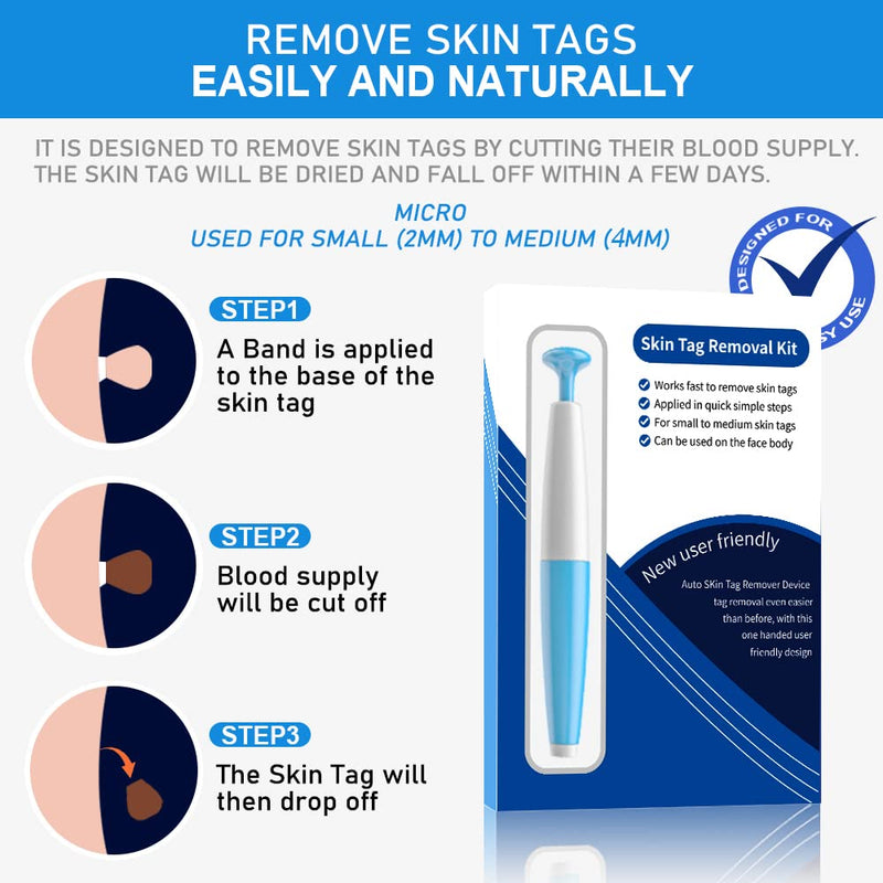 [Australia] - Skin Tag Remover, 40 Bands Skin Tag Removal Kit 2-4 mm with 36Pcs Repair Patches for Small to Medium Skin Tags, Application Device to Remove Skin Tags 