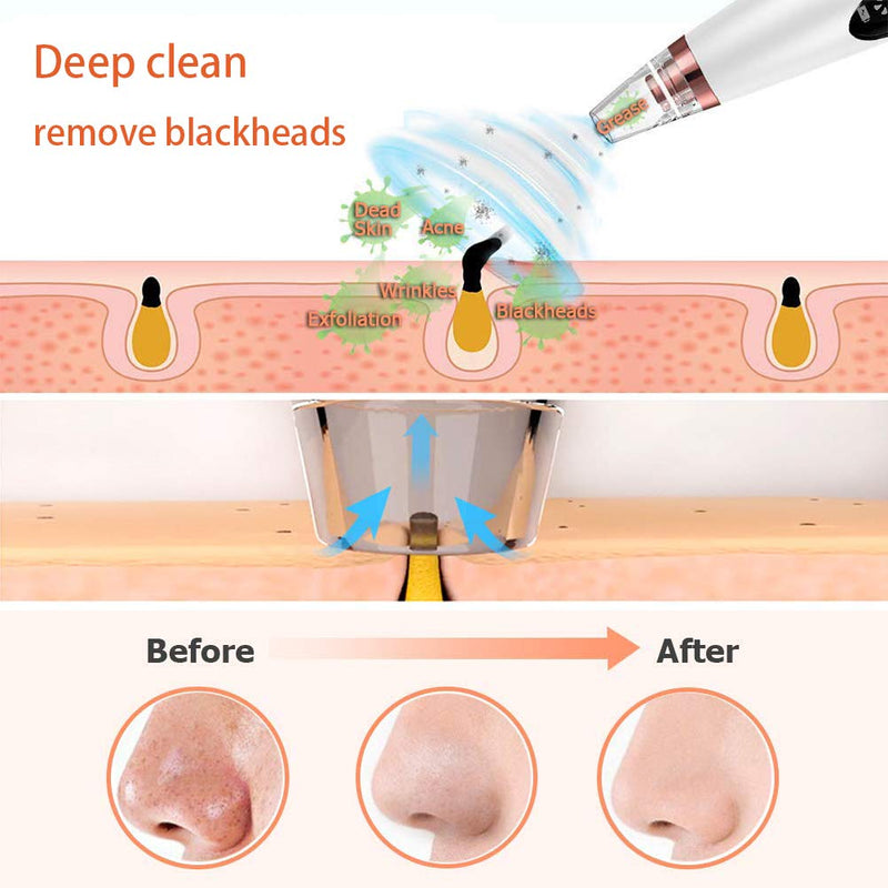 [Australia] - Blackhead Remover Vacuum, Electric Blackhead Removal Tools, Pore Cleaner Extractor Facial Cleaner Suction Tools USB Rechargeable with 6 Replaceable Suction Probes and 3 Cleaning Modes 