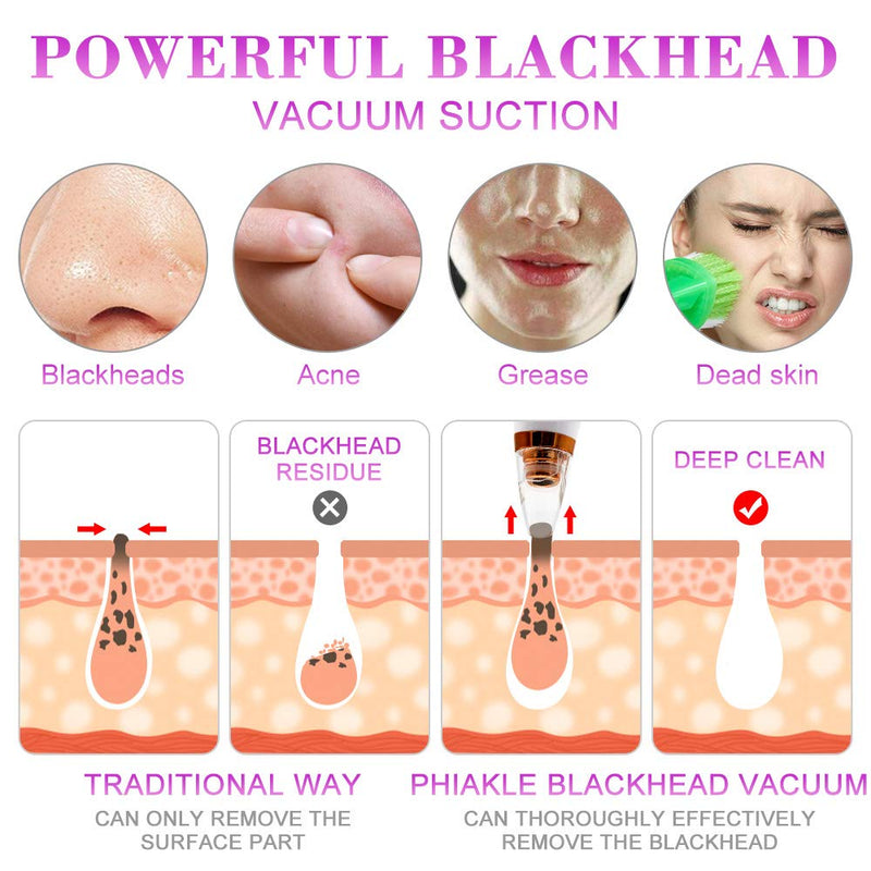 [Australia] - Blackhead Pore Vacuum Cleaner Remover 【2021 Newest Technology】 6 Probes 3 Suction Levels LED Display Blackhead Removal Strong Suction Skin Cleaner Machine’ (White) White 