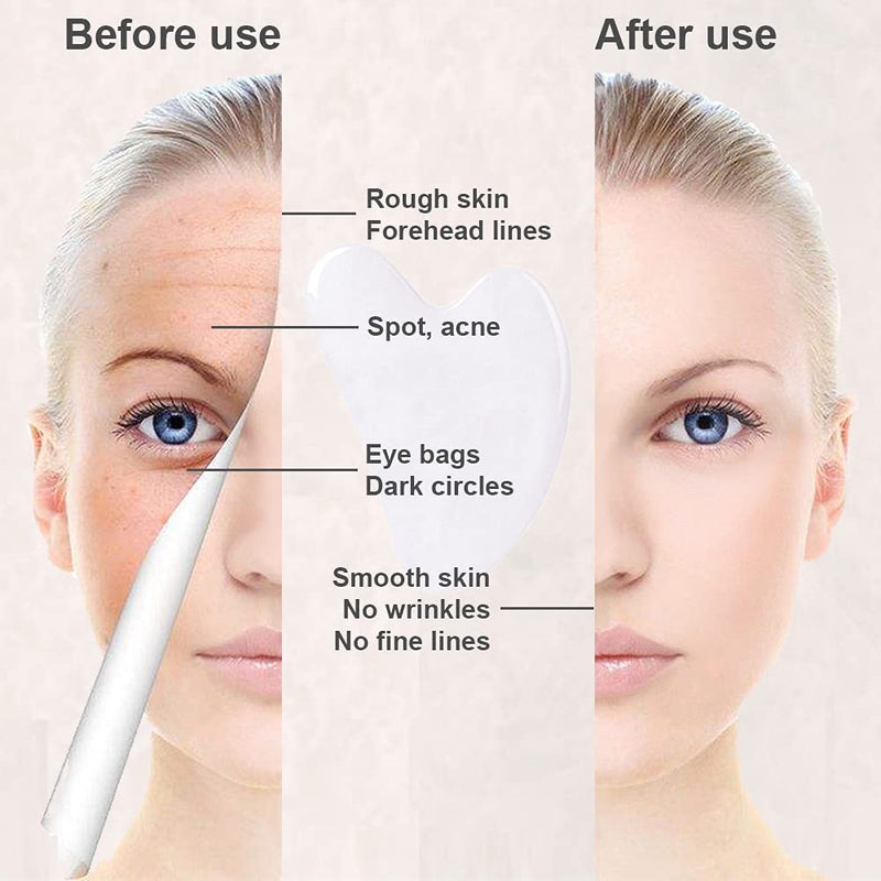 [Australia] - Gua Sha Facial Tools, Jade Gua Sha Stones Massage Scraping for Physical Therapy and SPA Acupuncture Therapy Used for Face, Eyes, Neck and Body (White) White 