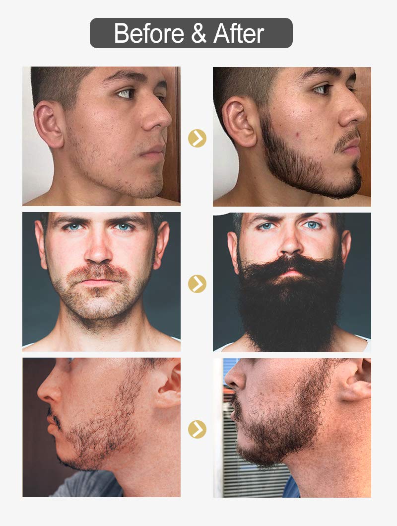 [Australia] - Ebeizi Beard Growth Kit, Beard Growth Oil Activator Serum, Beard Roller for Men, Derma Roller for Men, Beard Grooming Tools for Beard Rapid Growth and Thickening 