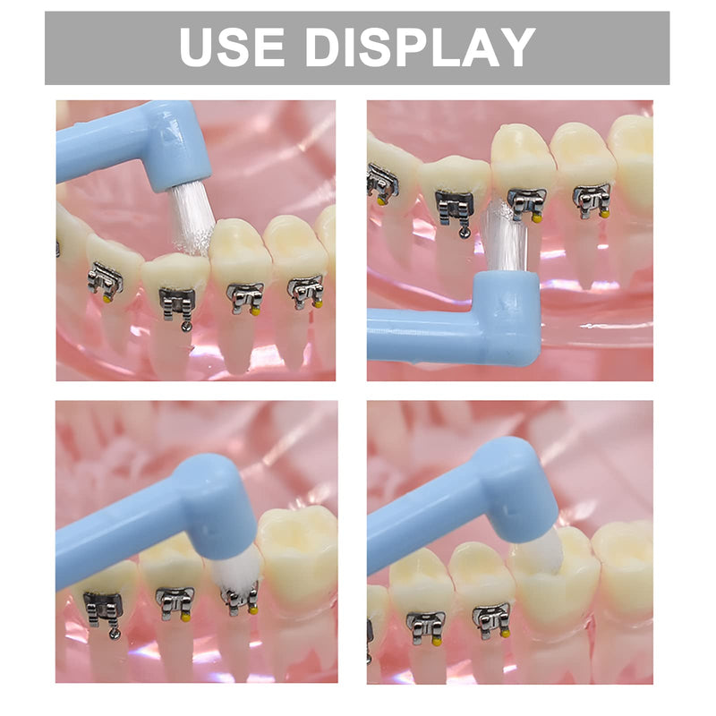 [Australia] - Tufted Toothbrush, 9PCS Orthodontic Interspace Toothbrushes Single Tuft Toothbrush for Teeth Detail Cleaning and Braces Clean Soft and Compact Trim Tooth Toothbrush 9 