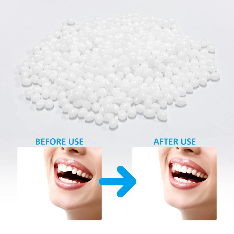 [Australia] - 20g Temporary Tooth Restoration Beads with 5 Floss Sticks, Tooth Filling Replacement, Missing Tooth Broken Tooth Filling Material for Missing Denture Defects 