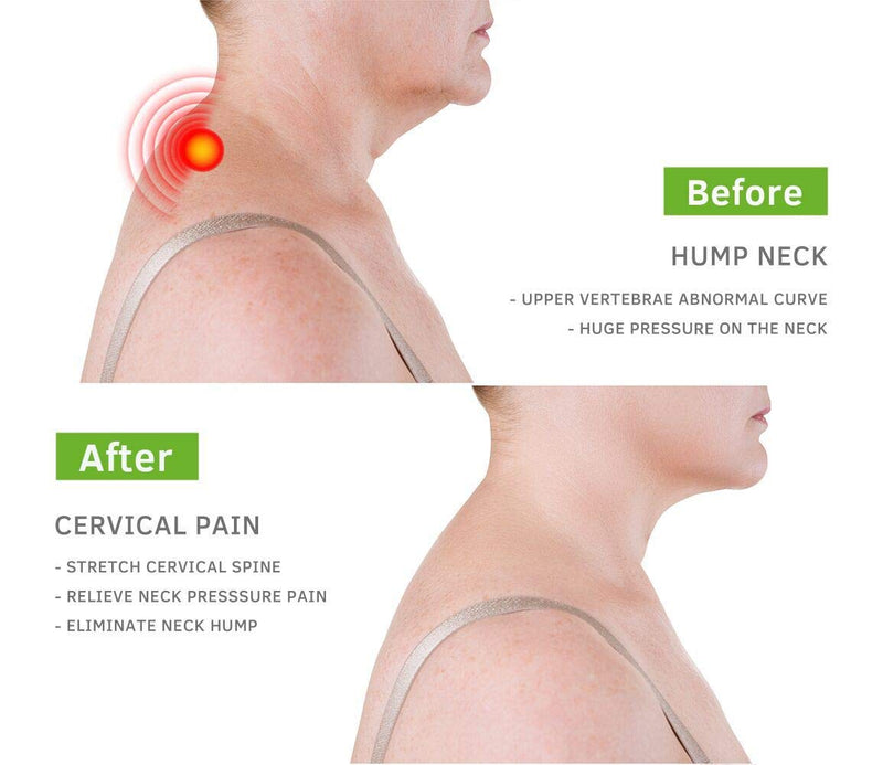[Australia] - Beibye- Upper Back and Headache Pain Relief - treatment for Costochondritis and Tietze Syndromeb-Help Back Stretcher, Posture Corrector 