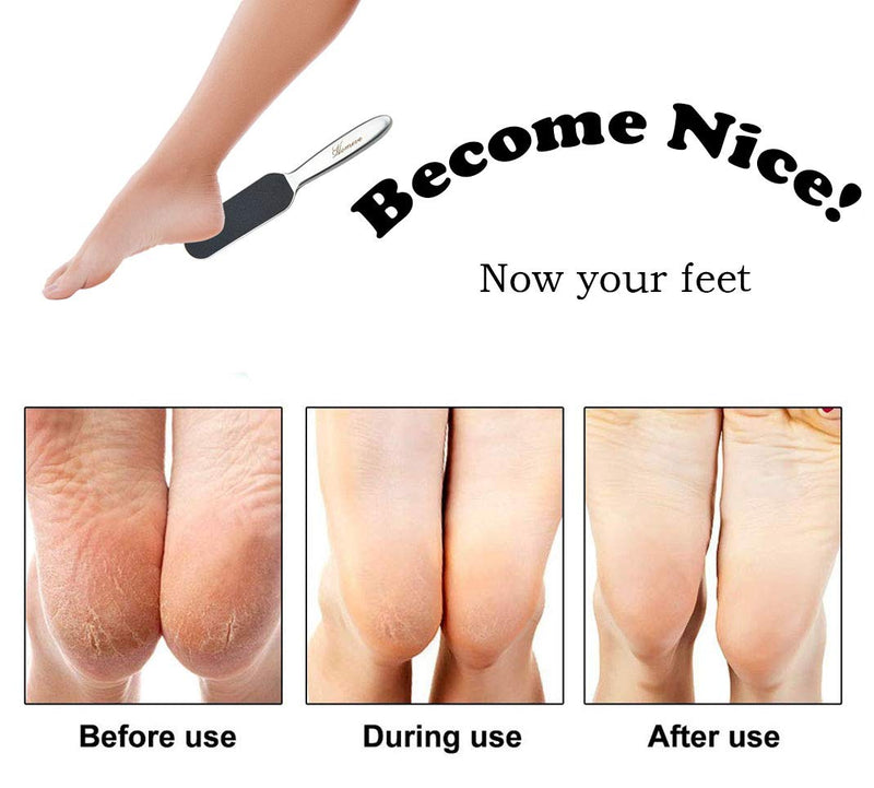 [Australia] - Professional Pedicure Foot File - Reusable Stainless Steel Cracked Skin Corns Callus Remover Feet Rasp 