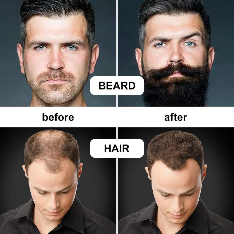 [Australia] - URAQT Beard Growth Kit, 6 Piece Beard Grooming Tools, Beard Derma Roller (0.5mm,1mm,1.5mm), Titanium Microneedle Beard Roller with Beard Brush Beard Scissors Comb for Men Beard Rapid Growth 6PCS 