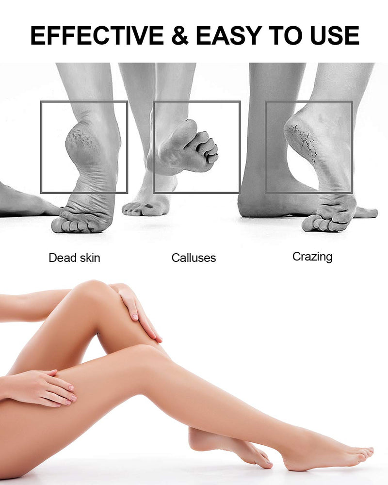 [Australia] - Callus Remover for Feet Pedicure Kit .Multifunctional and Detachable 3 in1 Foot Scrubber .Stainless Steel Foot File.Suitable For Both Wet And Dry Feet. 