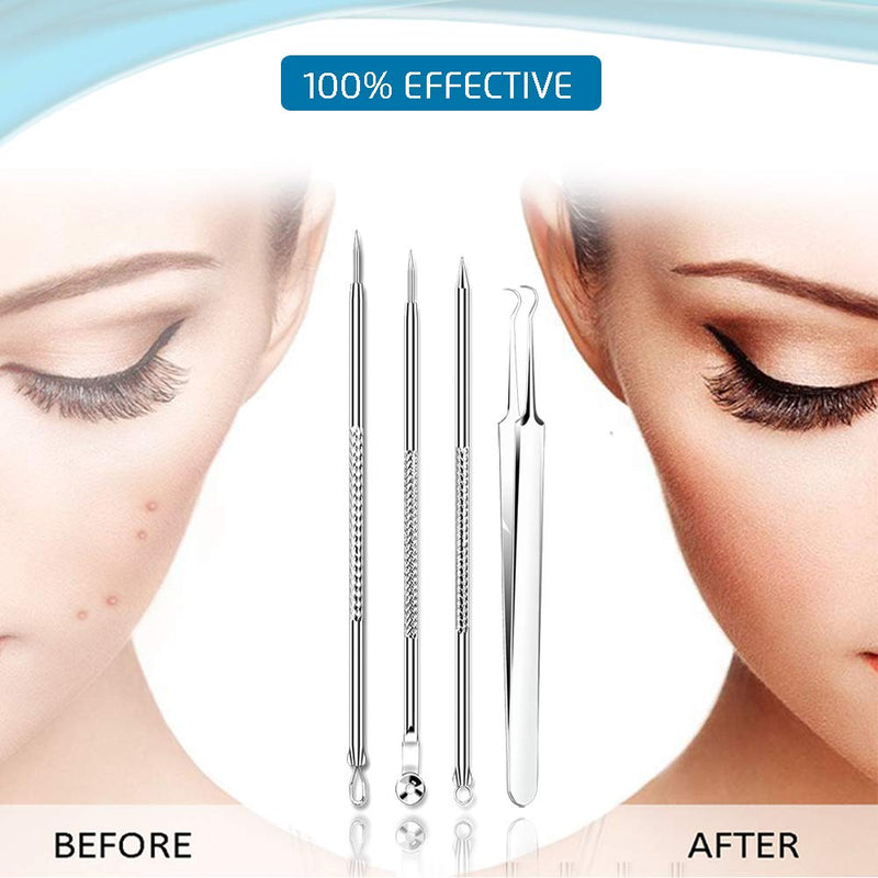 [Australia] - [Upgraded] 8PCS Blackhead Remover, Pimple Tool Kit, Acne Tools, Comedone Extractor, Blemish Whitehead Removal, Professional Curved Tweezers Kits, Premium Stainless Steel 