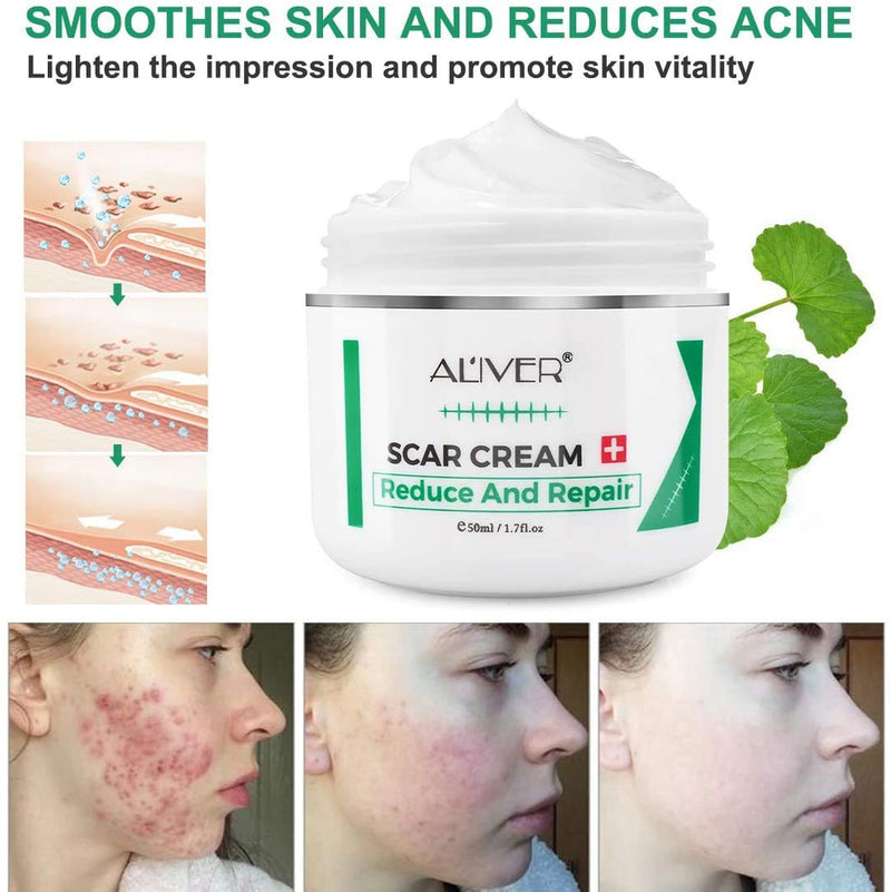 [Australia] - Scar Removal Cream for New Scars, Effective Stretch Mark Removal Natural Skin Repair Prevention of Insect Bites Scars, Face Skin Repair Gel for Men & Women 