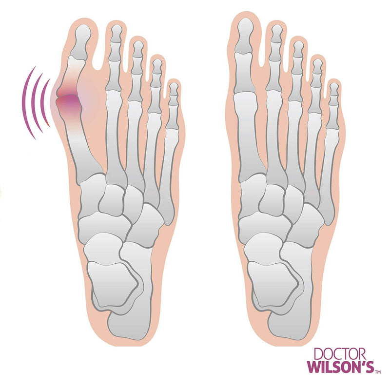 [Australia] - 2 Bunion Relief Pads Sleeve - Bunion Splint Orthopedic Bunion Corrector Socks - Gel Pad Elastic Cushions Men and Women (1 Pair) 2 Count (Pack of 1) 