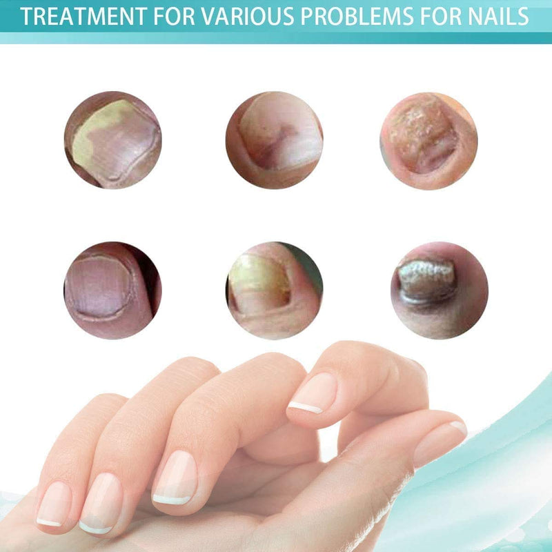 [Australia] - Fungal nail treatment, Nail Fungus Treatment, Anti fungal Nail Solution— Kills Fungus on Toenails & Fingernails(2PCS) 
