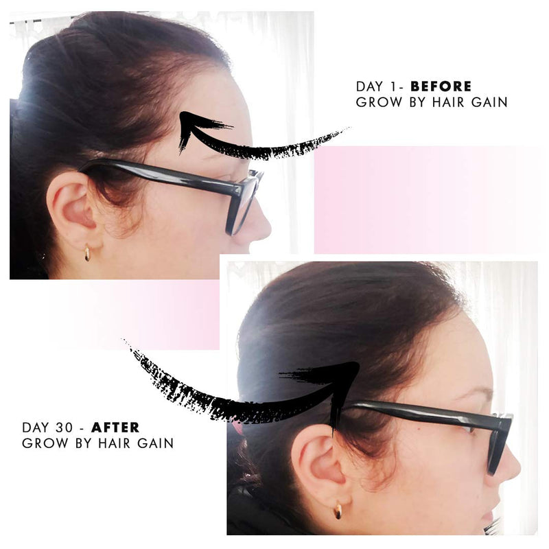 [Australia] - Grow by Hair Gain 1 Month supply 60 Capsules Fuller Thicker Hair in one month 