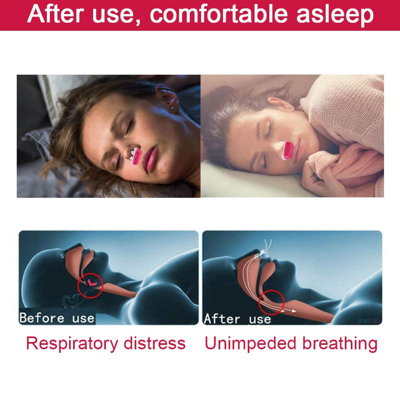 [Australia] - Anti Snoring Filter Devices, USB Rechargeable 2 in 1 PM2.5 Breathing Air Purifier Continuos Positive Airway Pressur Vents Nasal Dilator for Reduce Snore Red 