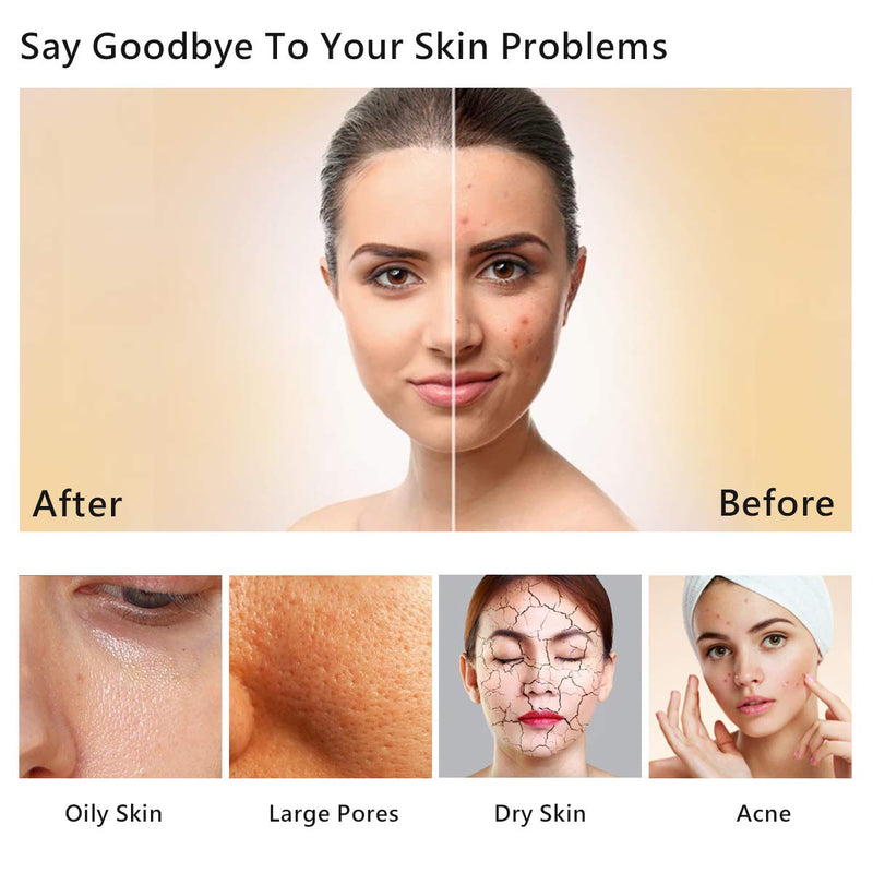 [Australia] - Wolady Facial Steamer, Nano Ionic Face Steamer Sauna Hot Mist for Face Spa Moisturzing Opening Pores with 4 Pcs Extraction Tools 