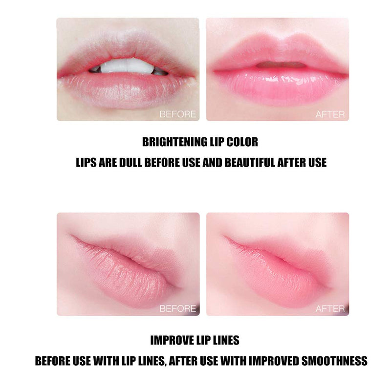 [Australia] - 2 Box Lip Sleeping Cherry Mask, Collagen Peptide Lip Treatment Lip Plumping Balm Moisturizes And Repairs Dry Chapped Lips, 20Pcs Of Box 