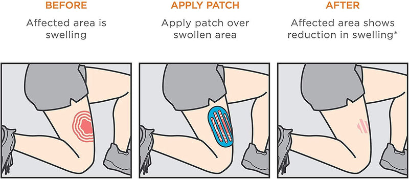 [Australia] - KT Tape Recovery Patch - Tape for Swelling Relief 