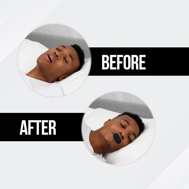 [Australia] - Longevity Sleep Tape - Mouth Tape for Sleeping, Snoring Aid, Improved Nasal Breathing, Strong But Gentle Adhesion (30 Strips) 