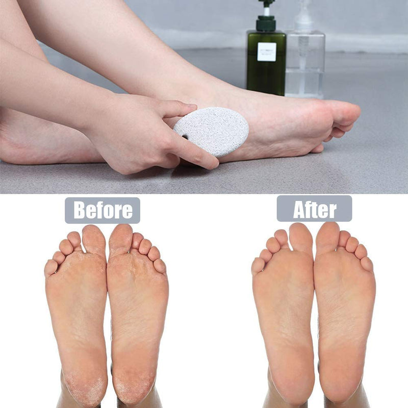 [Australia] - Pumice Stone 2Pcs, Natural Lava Pumice Stone for Feet/Hands/Body, White Calluse Remover/Foot Scrubber Stone for Dead/Hard Skin, Foot File for Men/Women by MAYKI Grey 