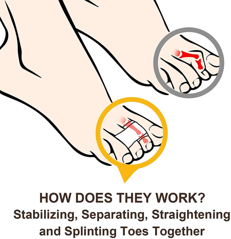 [Australia] - 6 Pcs Hammer Toe Straightener, Hammer Toe Splints, Crooked Toes & Overlapping Toes，Protecting Curved Toes and Hammertoes, Overlapping Toe Protector，Toe Cushioned Bandages for Correcting Hammer Toes 