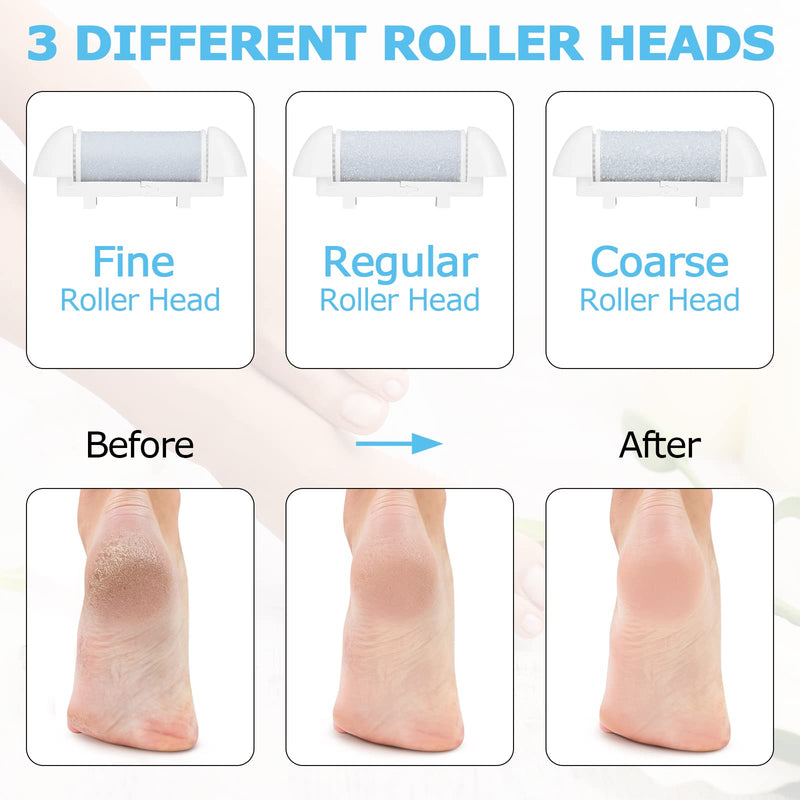 [Australia] - Electric Callus Remover for Feet, MENOLY 21 in 1 Rechargeable Professional Pedicure Kit with 3 Roller Heads Battery Display 2 Speed to Remove Cracked Heels Calluses Hard Skin for Hands Heels Spa 