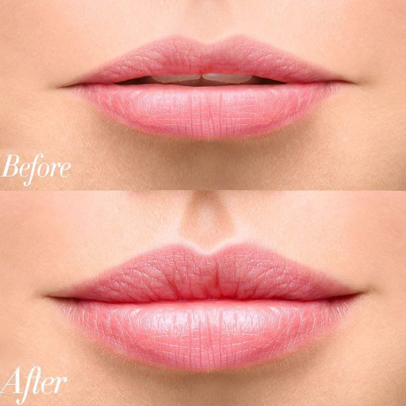 [Australia] - Lip Plumpers Tool Lips Care Enhancer Fuller Thicker Mouth Pumps Fastly Lip Plumping Bigger Device Peach Red 