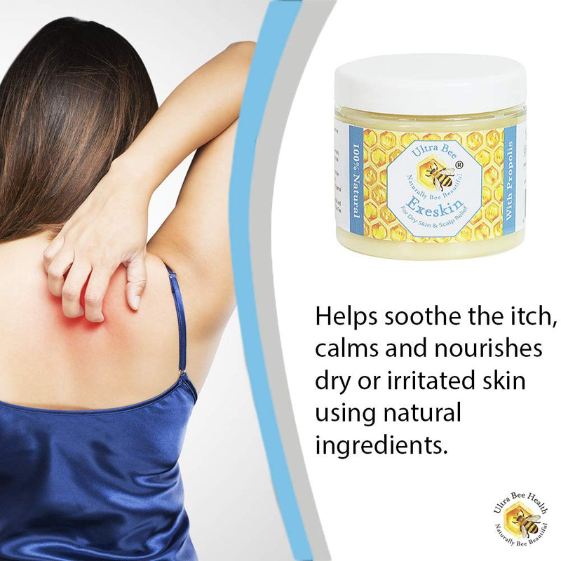 [Australia] - 100% Natural Exeskin Dry itchy Skin Balm suitable for People Prone to Eczema, Psoriasis,Dermatitis.Formulated with Beehive and Plant Products 100 ml 