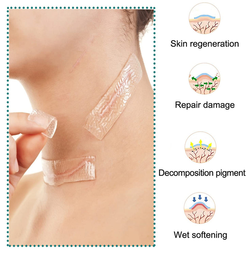 [Australia] - Silicone Scar Sheets, Silicone Sheet for Scar Removal, Gel Scar Repair Treatment Remover for Skin Fast Effective on Keloid Surgery Burn Acne C-Section Stretch Marks 