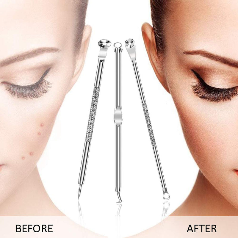 [Australia] - 6PCS Dual Heads Blackhead Remover, Pimple Comedone Extractor, Acne Whitehead Blemish Removal Kit, Premium Stainless Steel, Risk Free For Face Skin, With Portable Box 