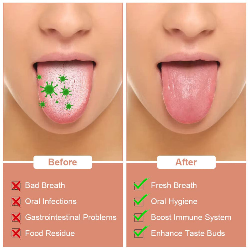 [Australia] - ACWOO Tongue Scraper, 3 Pack Stainless Steel Tongue Cleaners with Travel Case, Tongue Cleaner Tool for Oral Hygiene, Fresh Breath, and Reduce Bad Breath, Reusable Tongue Scrapers for Adults Rose Gold 