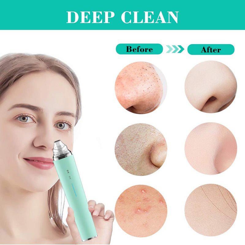 [Australia] - CLEASO Blackhead Remover Vacuum, Pore Vacuum With Camera, Upgraded Face Suction Pore Cleanser, 3 Suction Power & 6 Probes, Usb Rechargeable Built-In Camera & Wifi Real-Time Skin Screen (Green) green 
