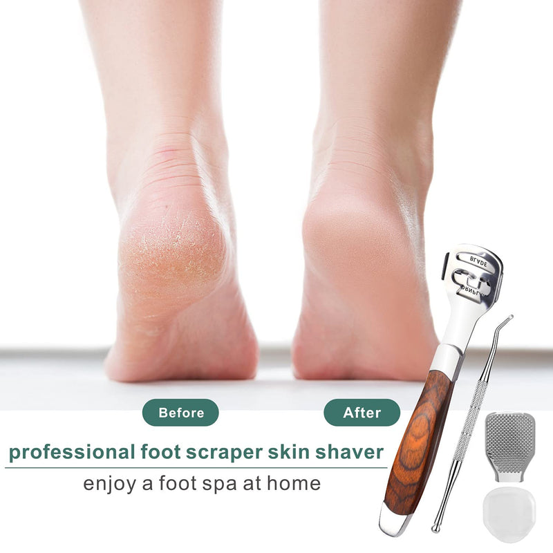 [Australia] - 54PCS Callus Shaver Foot File for hard skin, Callus Remover KOAOAUS Hard Dry Skin Remover for Hand Feet, Ingrown Toenail File 