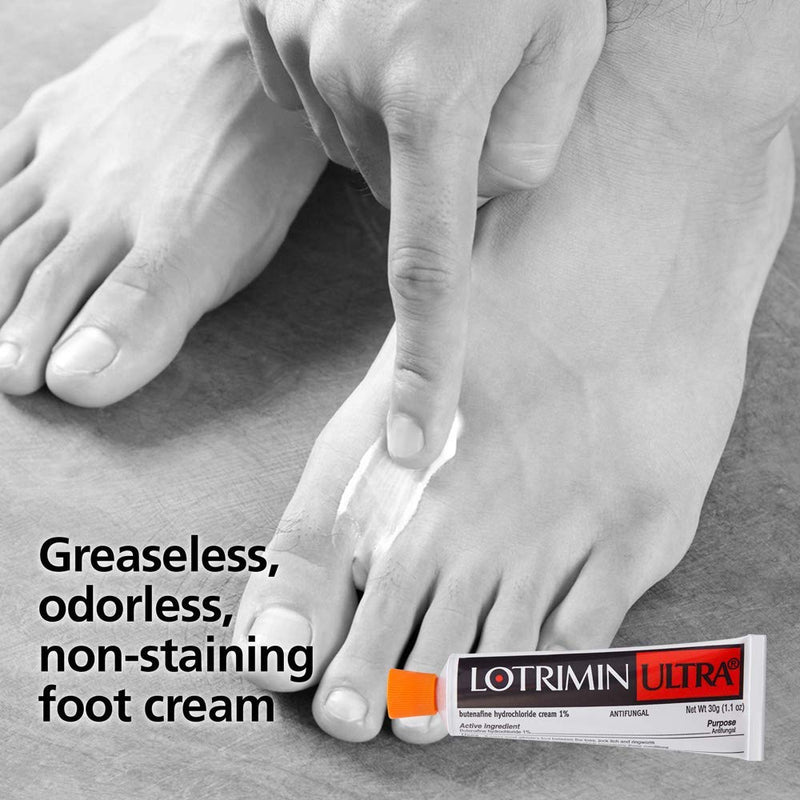 [Australia] - Lotrimin Ultra 1 Week Athlete's Foot Treatment, Prescription Strength Butenafine Hydrochloride 1%, Cures Most Athlete’s Foot Between Toes, Cream, 1.1 Ounce (30 Grams) 1.1 Ounce (Pack of 1) 