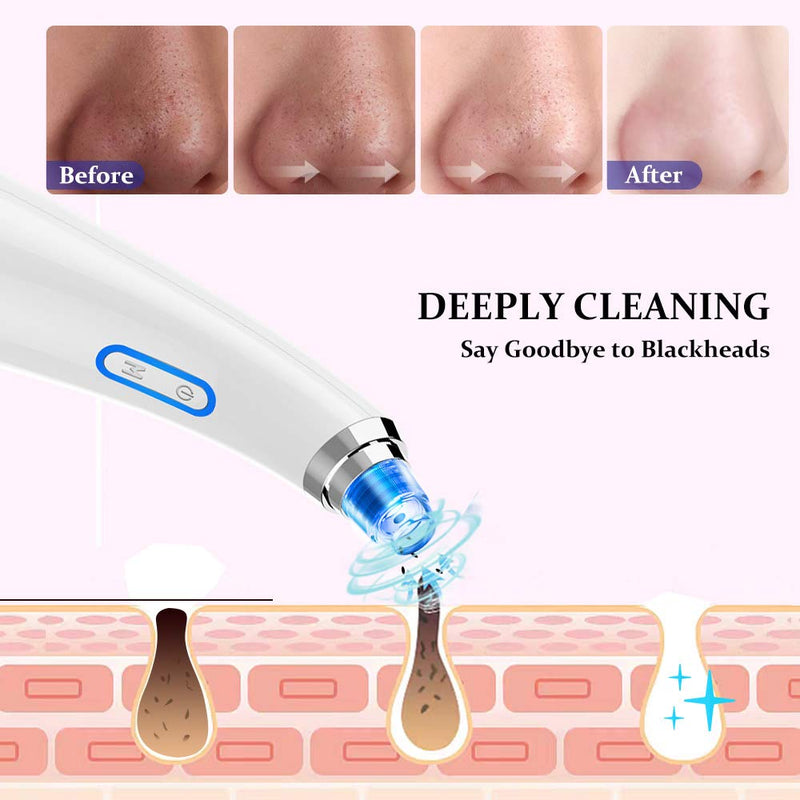 [Australia] - Blackhead Remover Vacuum - USB Rechargeable Blackhead Suction Device with 4 Adjustable Suction Levels and 4 Removable Probes - Pore Vacuum Suction Acne Extractor for Women and Men 