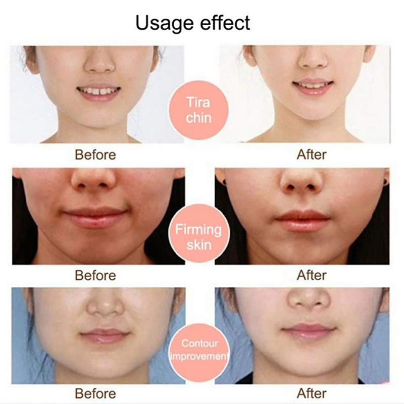 [Australia] - Face Slimming Bandage,Facial Slimming Strap,Graphene Face Slimming Bandage Reduce Double Chin Thin Face Anti Wrinkle Facial Massager Face-Lift Belt 